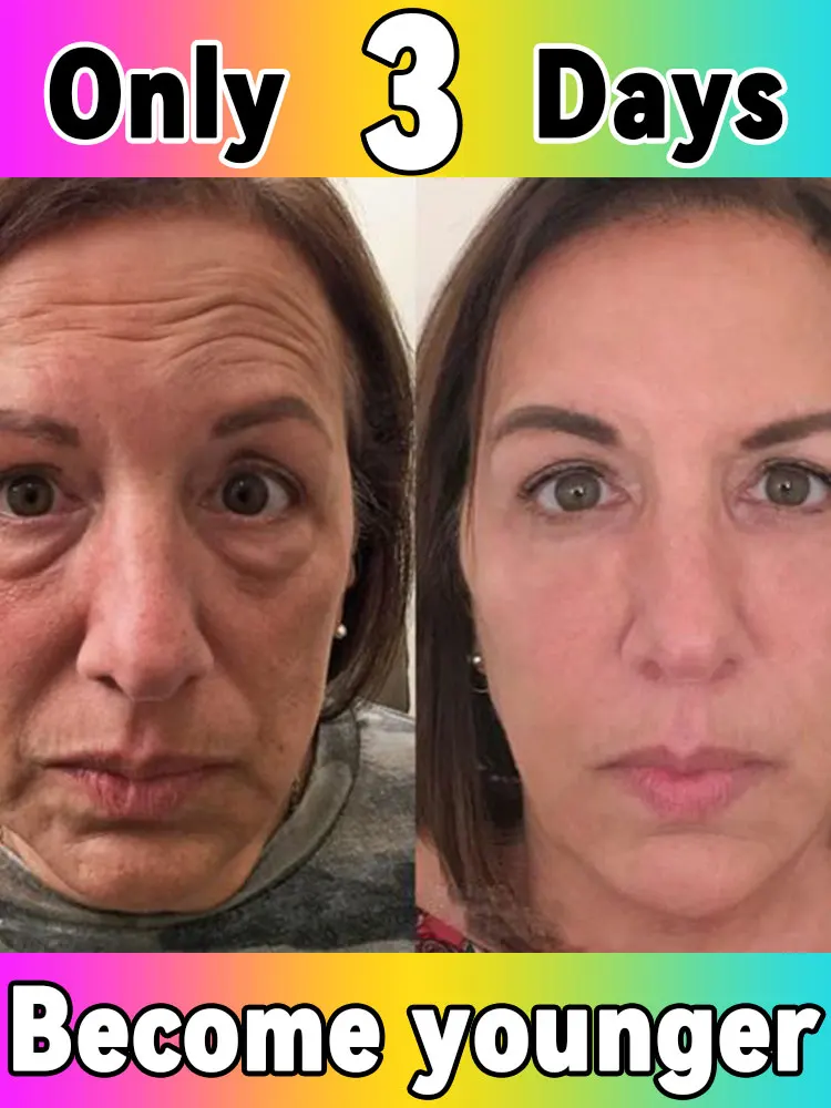 

Rejuvenation, no fine lines