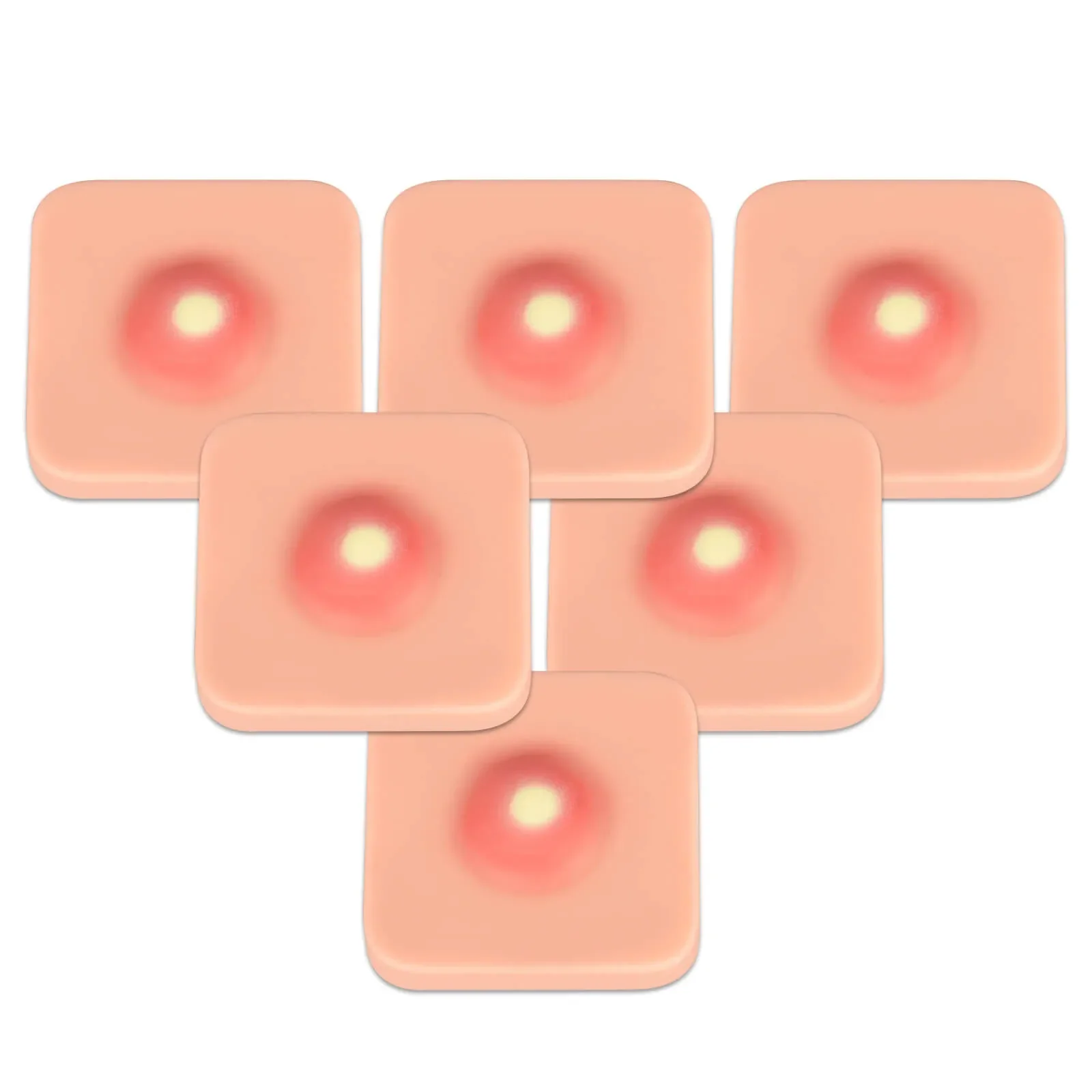 Ultrassist Abscess I&D Incision and Drainage Pad Trainer (6-Pack)