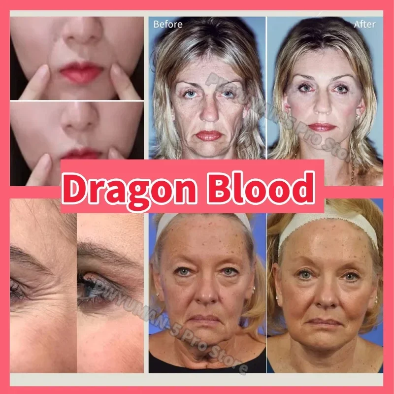 Dragon Blood Fast Wrinkle Remove Face Serum Placenta Royal Anti-Aging Firming Lifting Whitening Moisturizing Skin Care Cosmetics