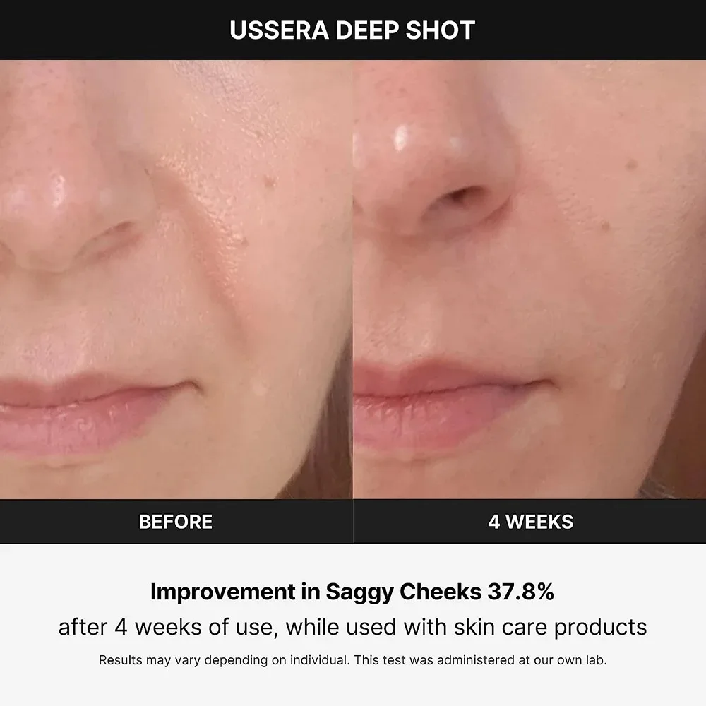 Mini Hifu Machine for Eyes Rechargeable Ultrasound Machine Rf Radio Frequency Ems Microcurrent Lift Firm Tightening Skin Care