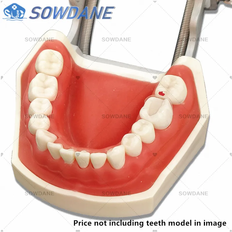 Dental Clear Matrix Bands Transparent Matrice Posterior Molar Composite Class Restorative Matrices 4.5/5.5/6.5/8.0 Fits Bioclear