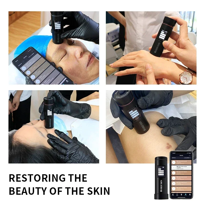 Skin Color Analyzer Spectrophotometer/skin Analyser Scanner Analyzer
