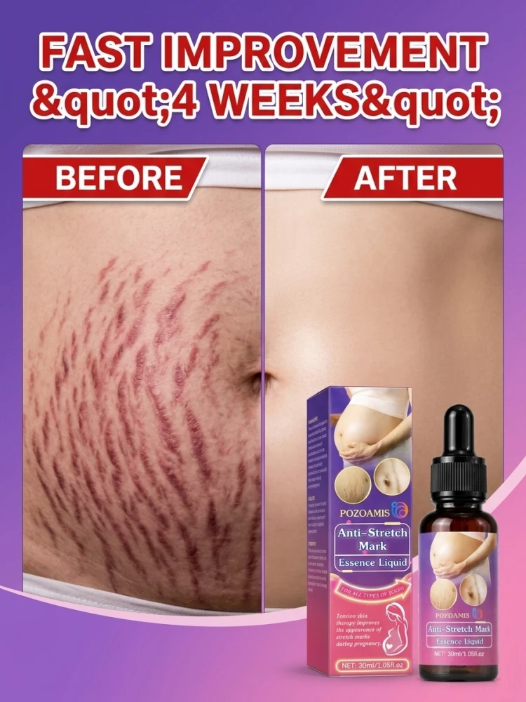 Massage Essence Oil for Stretch Mark & Scar Skin, Help Soften Dry Rough Skin Texture, Improve Visible Stretch Mark Appearance, Deep Hydrating Body Skin Serum