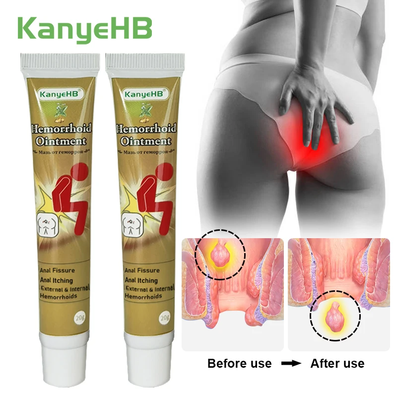 

2Pcs Hemorrhoids Ointment Chinese Herbal Medicine Hemorrhoids Cream Treat Internal Hemorrhoids Piles External Anal Fissure A646