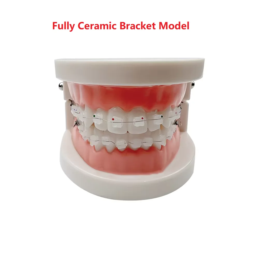 Dental Teaching Modell Standard Dental Kieferorthopädische Zähne Modell Mit Zahnspangen Metall/Keramik Klammern Für Zahnmedizin Bildung Studie
