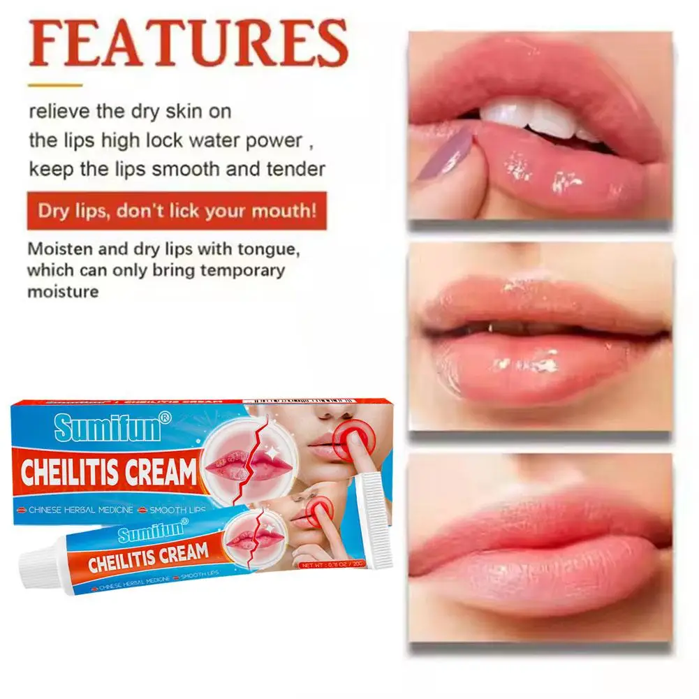 20g Cheilitis Balm cura delle labbra crema esterna per la pelle per Peeling screpolato secco e labbra sanguinanti