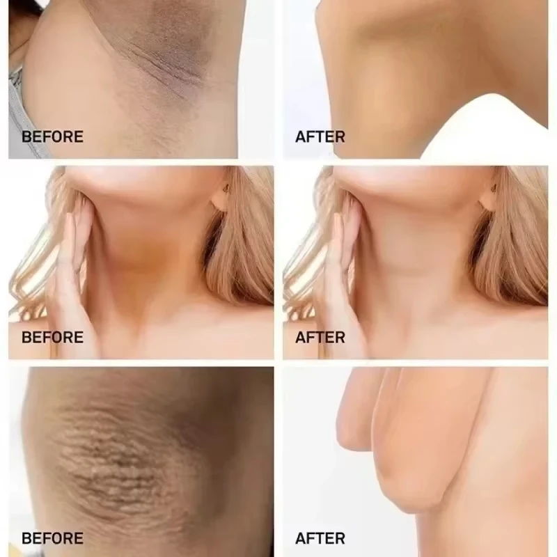 Body Whitening Cream Fade Joint Elbow Knee Armpit Pigmentation Underarm Melanin Bleaching Moisturizing Dark Spot Corrector Cream