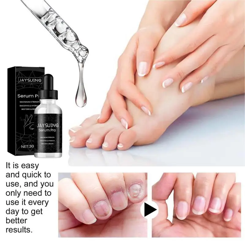 Feet Nails Repair Essence 30ml Fungi Toe Nail Solution Toe Nail Strengthener Multi Purpose Nail Renewal Essence Solution