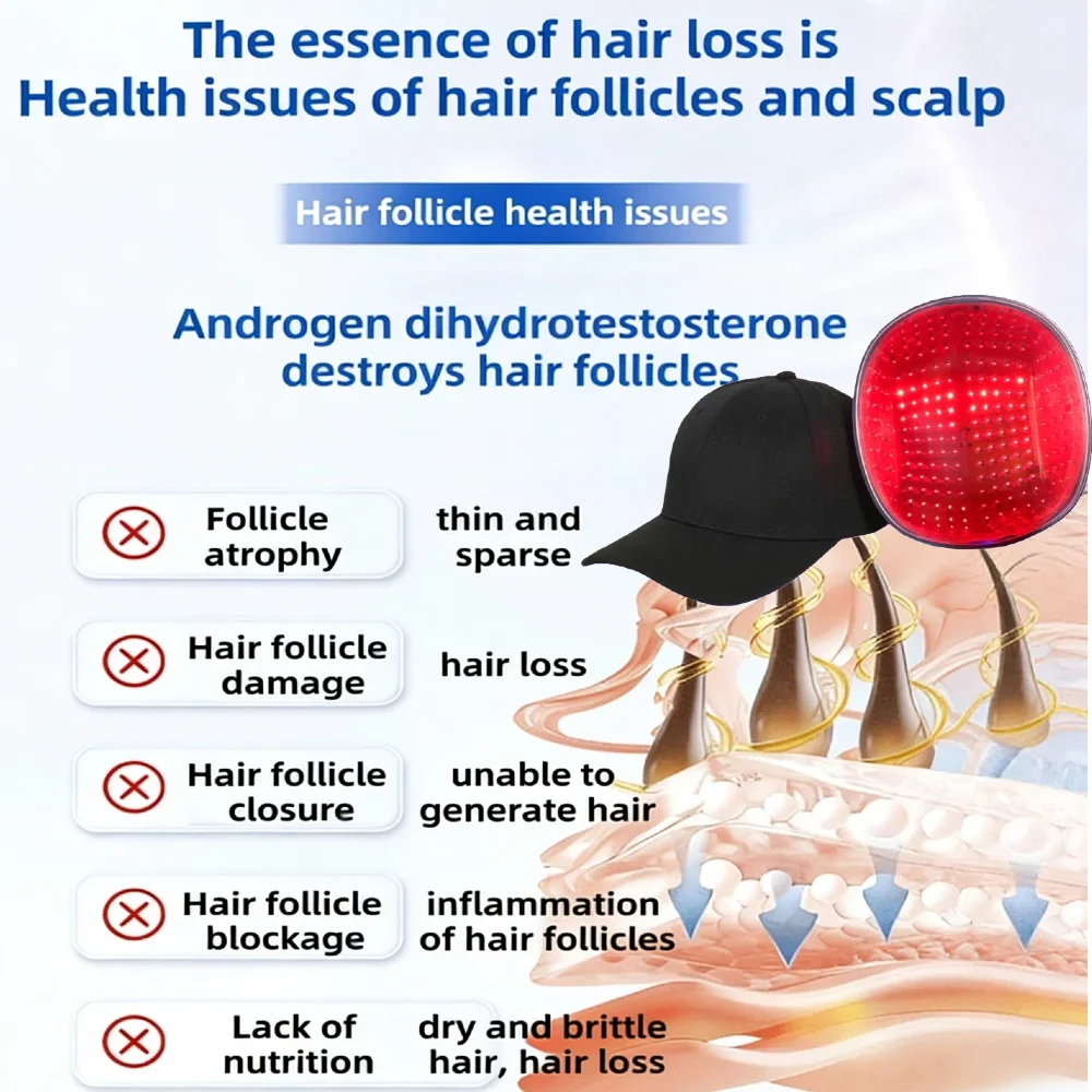 

Hair Restoration Laser Cap 96 Diodes LLLT Laser Hair Regrowth Enhance Therapy Scalp Coverage Caps for Men Hair Growth 510K