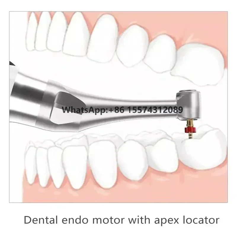 Wireless endo motor apex locator - wismy endomotor with