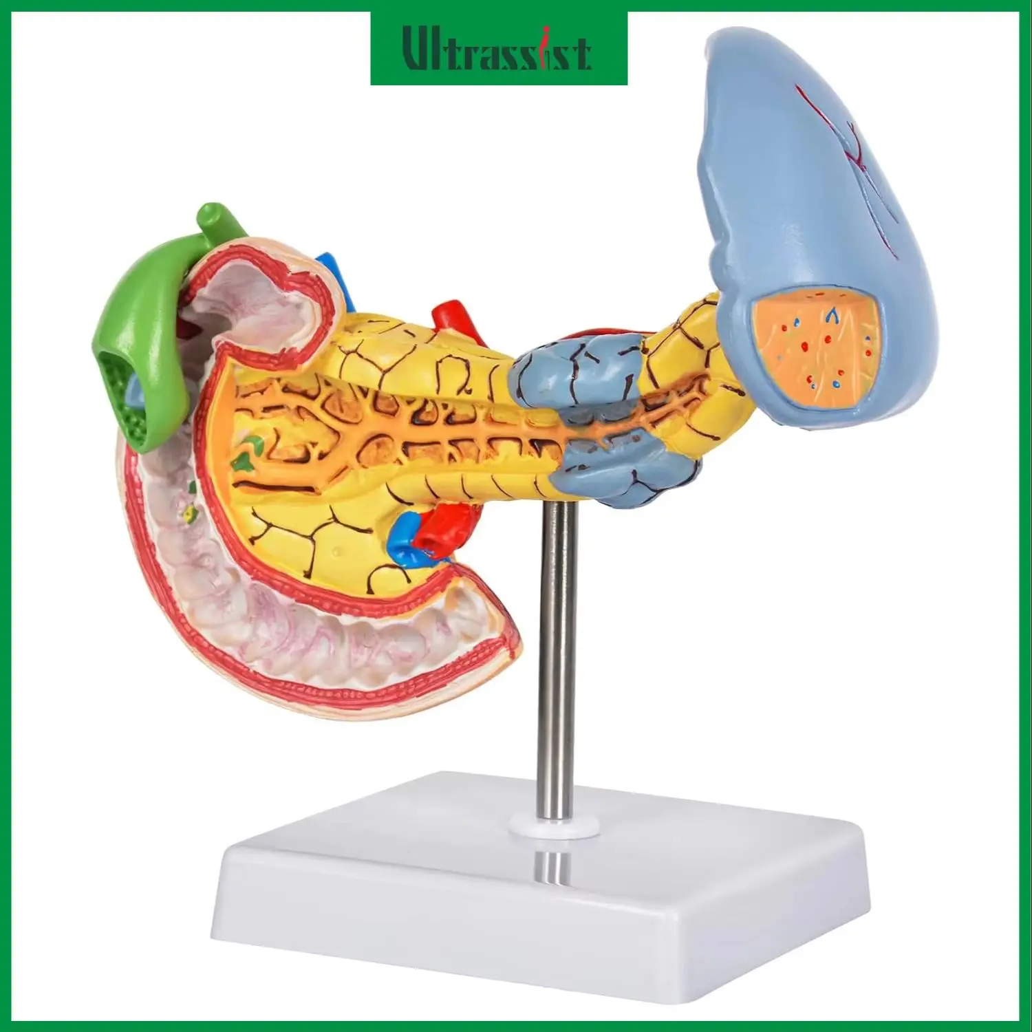 

Ultrassist Human Pancreas & Spleen Anatomy Model Pathological Structure Assisted Dissection Models for Medical Student Education