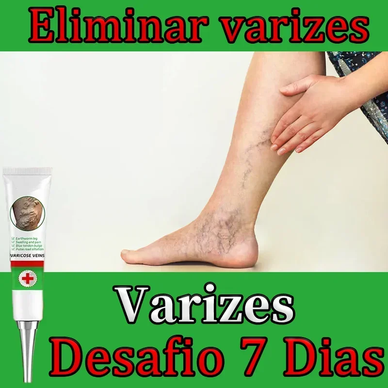 Varicose vein specific drug treatment leg swelling of earthworm blue veins raised official genuine special