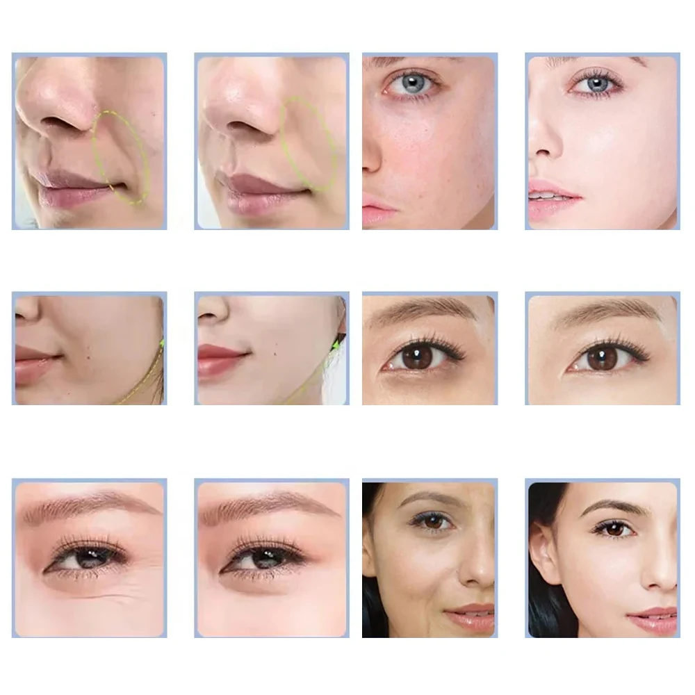 ガルバニックマイクロカレントフェイシャルスキン引き締め美白マシンイオン導入ニキビ毛穴黒ずみ除去マッサージャースキンケア療法