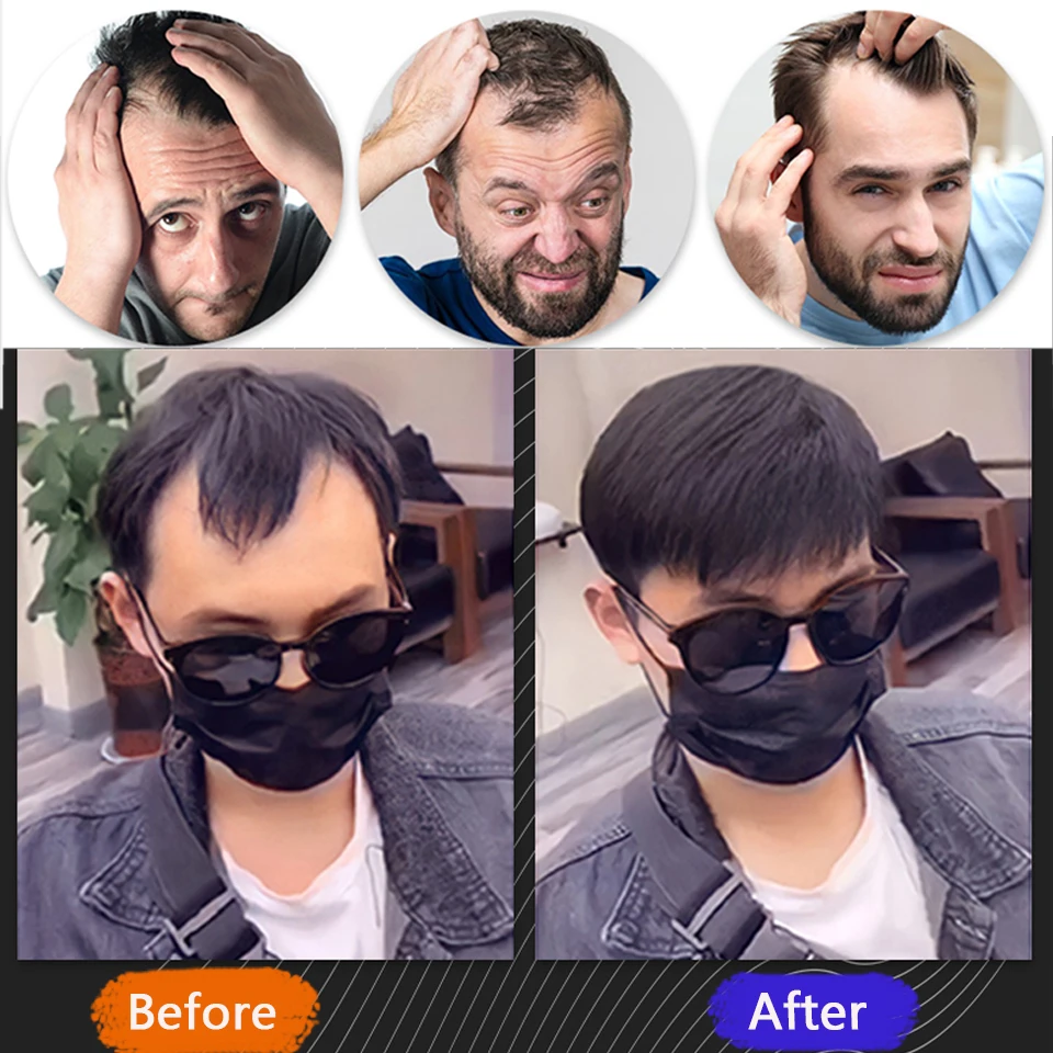 Pageup Synthetic Forehead Hairline Toupees Men\'s Short Straight V Style Hair Piece Hair Extension Natural Hair Fashion Style Ha