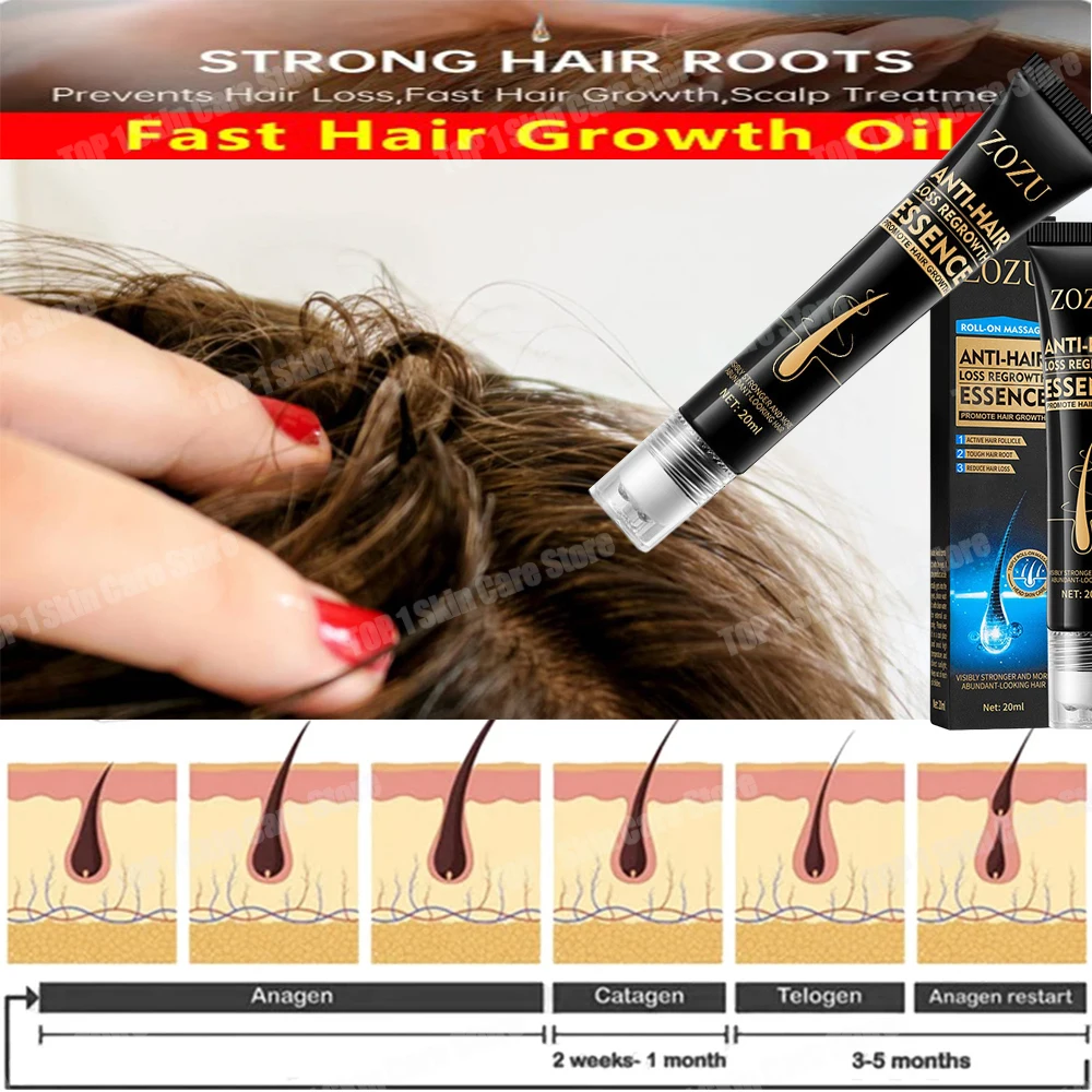 

Fast Hair Growth Essential oil Promoter aHair Loss Hereditary Seborrheic Alopecia Treatment For aHair Growth Essence Natural