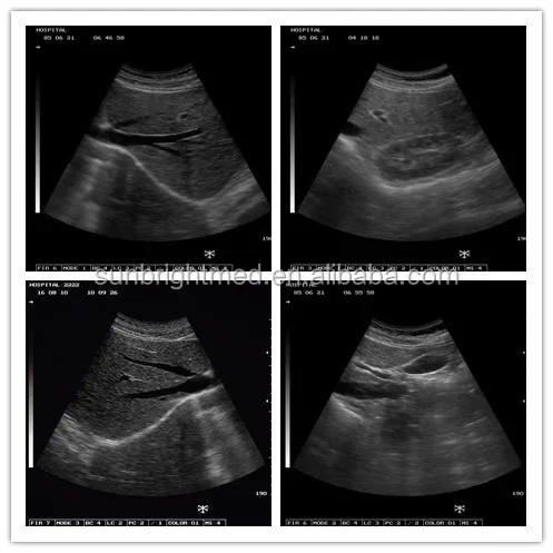 Peralatan diagnostik dokter hewan, ultrasonik Laptop portabel B mesin Ultrasound