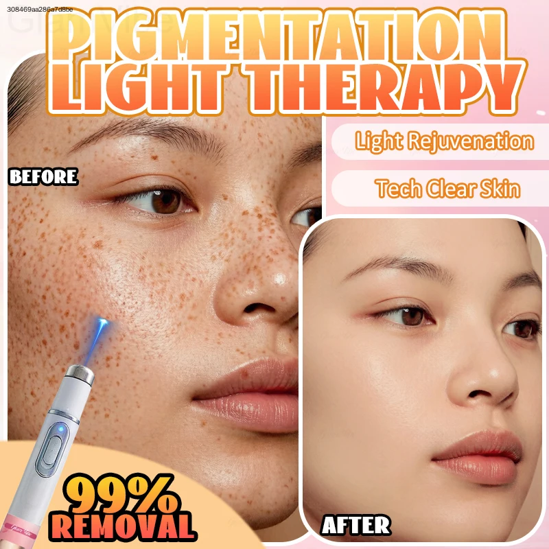 Electric Dark Spot Remover Pen Plasma Mole Sweep Machine Fade Freckles Eliminate Acne Marks Blemish Skin Tag Eraser Beauty Device Repair Smooth Skin Care Brightening Tool For Face Body Home Use