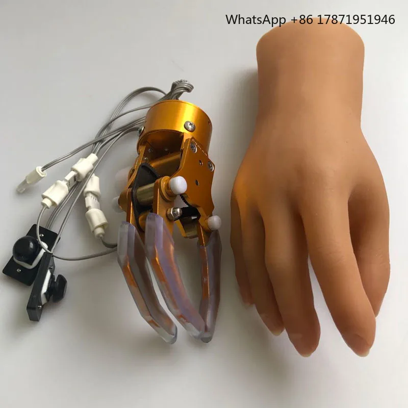 Prosthetic Hand Prostheses Controlled By Switch  With One Degree Of Freedom For Children Prosthetic Hand