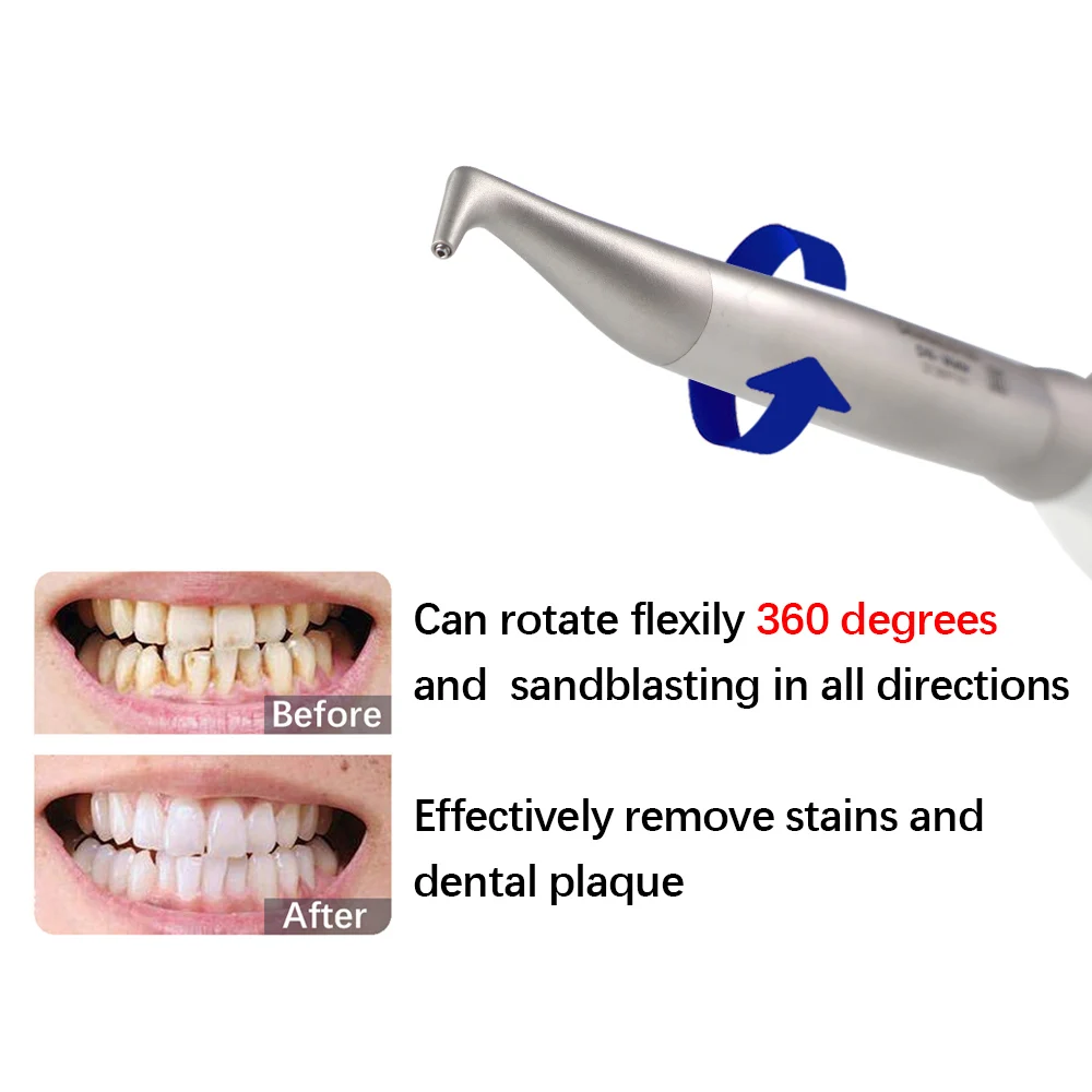 Dental Air Flow Teeth Polishing Polisher Handpiece Hygiene Prophy Jet Dentistry Tools KV Quick Connect