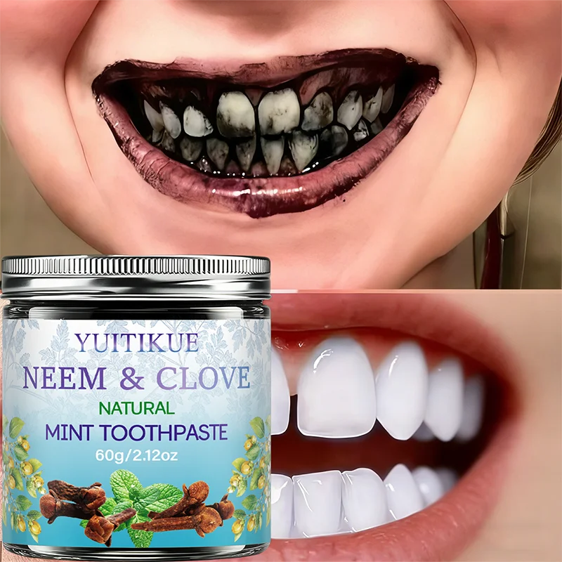 Plant‑Derived Herbal Teeth‑Cleaning Paste Neem & Clove Extract Freshen Breath Gentle Daily Oral‑Hygiene Care