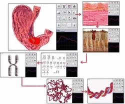 2023 Aura Chakra Metatron 4025 Hunter Bioresonance NLS 18D 25D Health Analyzer Therapy Machine Biofeedback Body Scanner