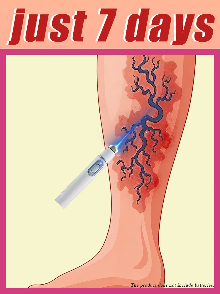 

Uᴘɢʀᴀᴅᴇᴅ ʙʟᴜᴇ ʟɪɢʜᴛ ʟᴀsᴇʀ ᴛʀᴇᴀᴛᴍᴇɴᴛ ᴄᴀɴ ʀᴇʟɪᴇᴠᴇ sᴏʀᴇɴᴇss ᴀɴᴅ sᴡᴇʟʟɪɴɢ.