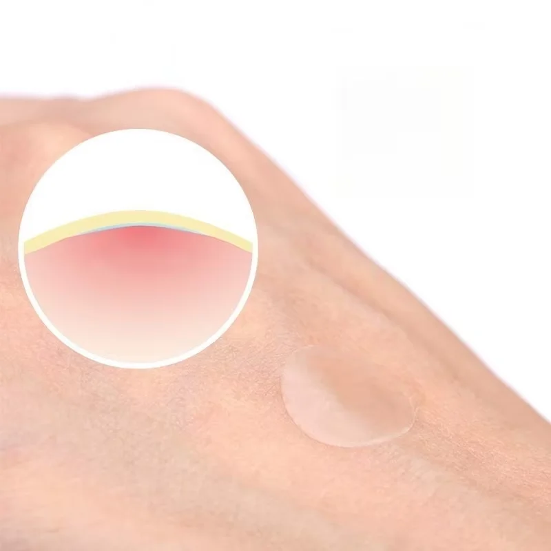 Hydrocolloïde onzichtbare waterdichte anti-acne-pleisters Waterdichte en ademende puistjespleisters met salicylzuur