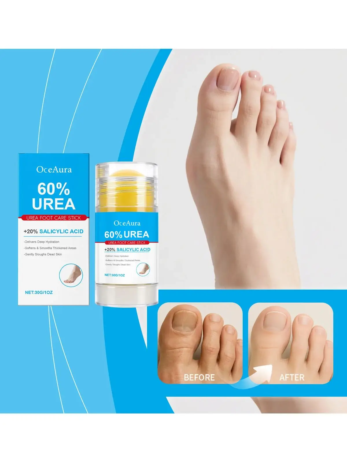 Bâton de crème pour les pieds à l'urée, hydratant, exfoliant, adoucissant, soulage le séchage, réparation du talon craquelé, hydratation en profondeur, soins pour la peau, 60%