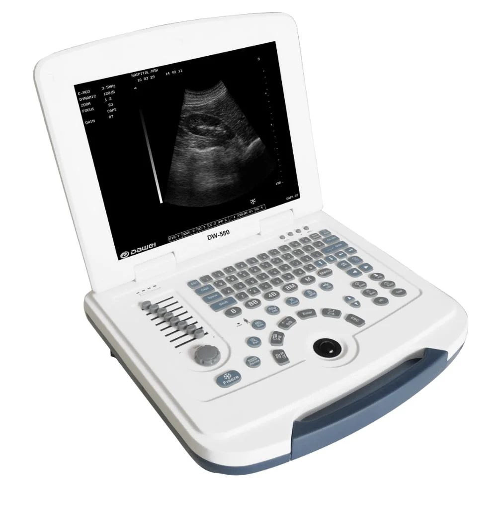 

Cheapest Clinic 2d diagnostic ultrasonic gel machine ultrasound portable for human