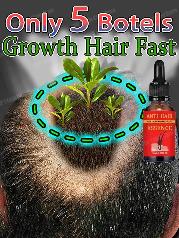 

Fast Hair Growth Oil Hair Regrowth Serum aHair Thinning Treatment aHair Growth Liquid Anti-Hair Loss for Women and Men