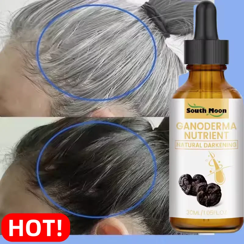White Hair Killer Remove Gray Hair Restore Natural Hair Color In 7 Days Effectively Repair Damaged Hair Maintain Hair Health New