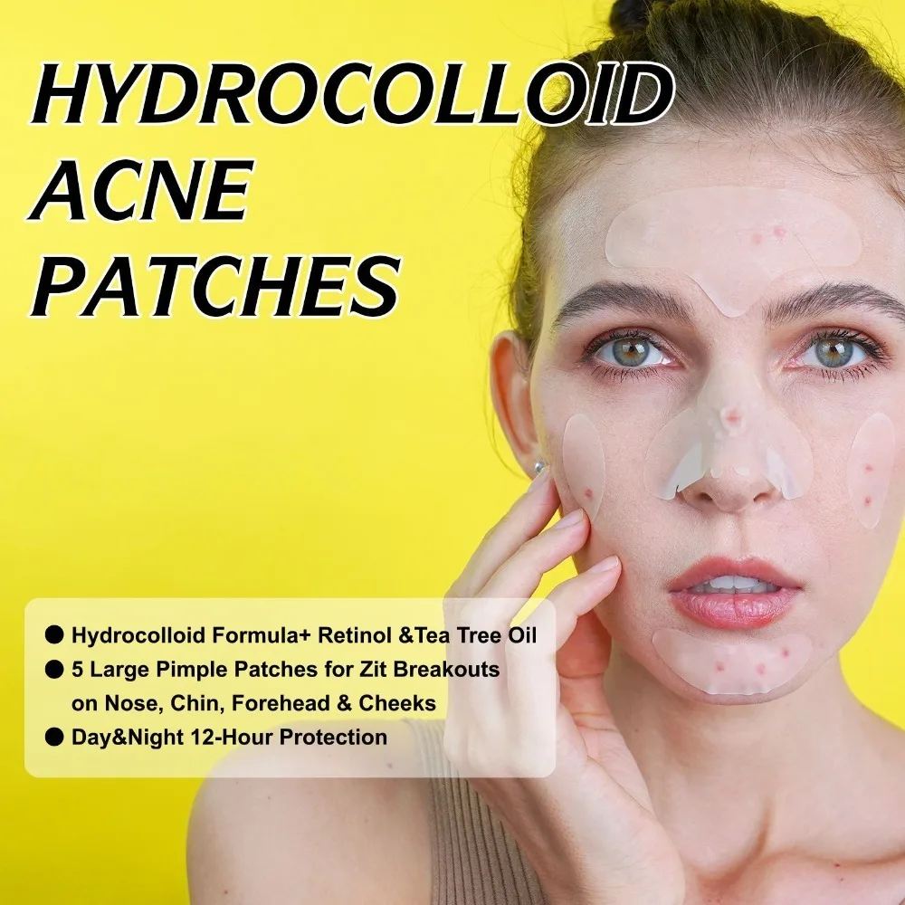 إزالة حب الشباب الغروانية المائية الكبيرة بقع بثرة الوجه بالكامل للأنف والذقن والجبهة والخد وحماية البشرة وتنظيف الوجه