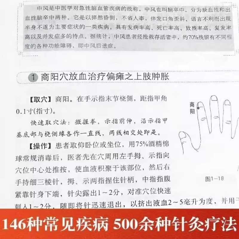 모든 종류의 질병에 대한 침술, 146가지 일반 질병에 대한 500가지 이상의 침술 및 뜸 방법