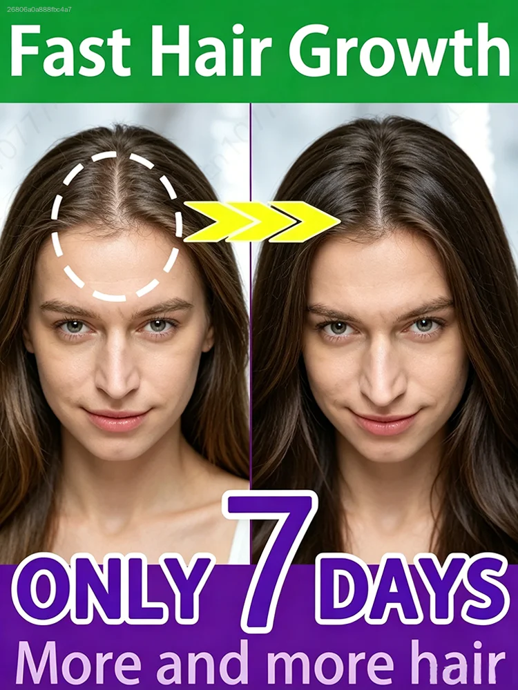 

Unisex, Saves High Foreheads Without Shaving