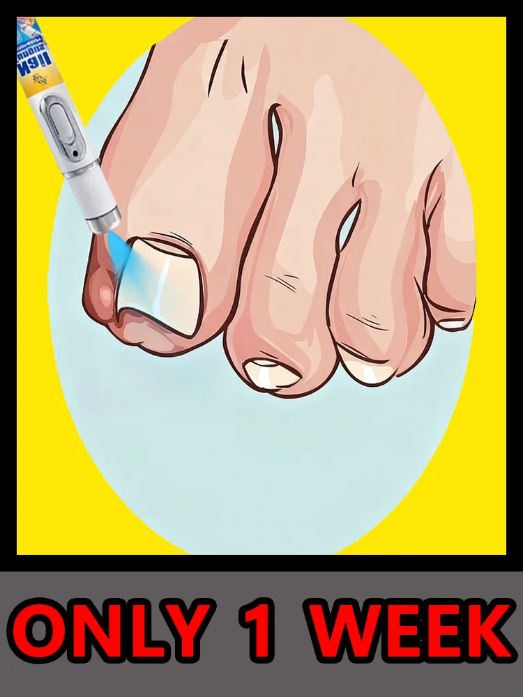 قلم الضوء الأزرق الأكثر مبيعًا في هذا الشهر لزراعة فطار الأظافر #1