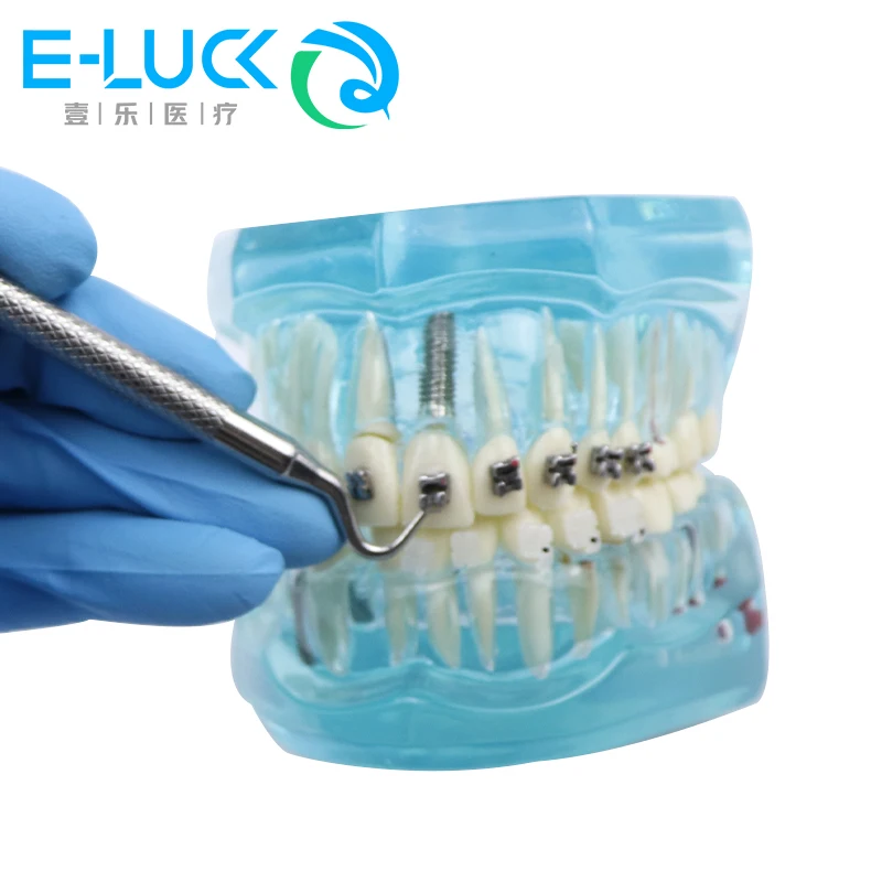 Dental Selbst Halterung Opener Werkzeug Kieferorthopädische Öffnung Selbst Beleitende Passive Halterung Stahl Edelstahl Instrumente – Detail 7
