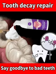 decay Tooth Repair Repairing Cavities Protect Anti caries