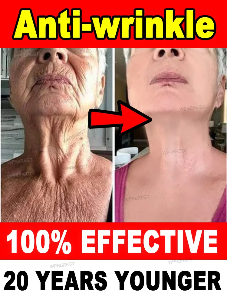 20 years younger, 100% wrinkles disappear