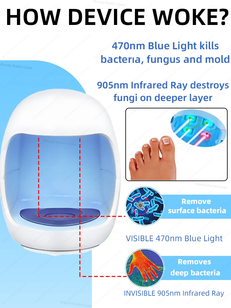 Produkt laserowy do rozwiązywania problemów z paznokciami