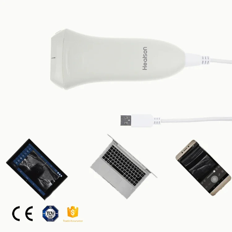 HD Image 7.5MHZ Digital Handheld Probe type Ultrasound Scanner