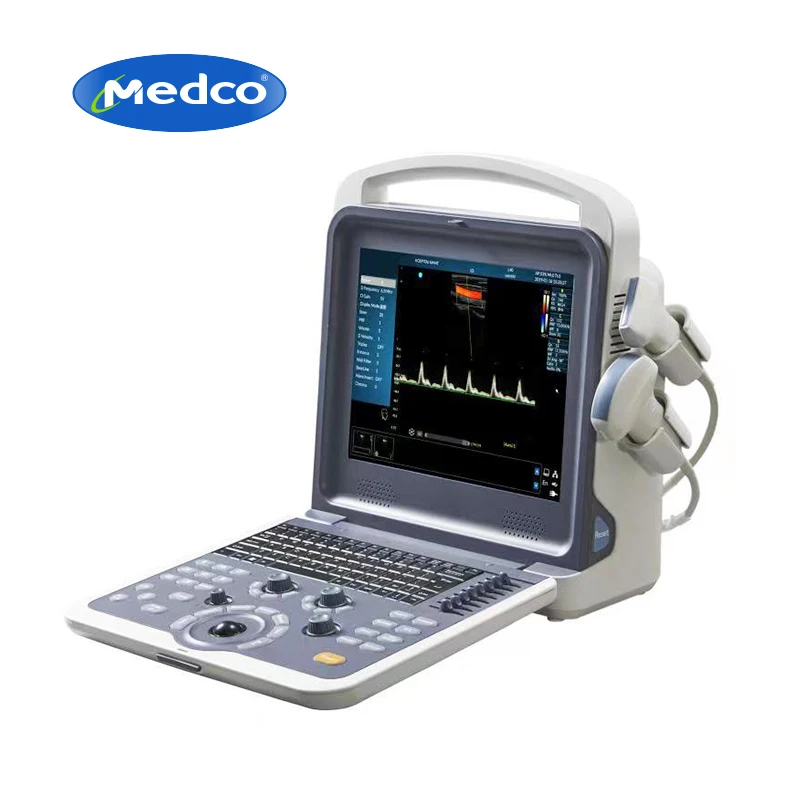 Medical portable 4d full digital color doppler b ultrasound scanner machine