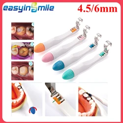 Dental Forming Sheet Matrix Bands Retainerless Automatrix Dentist Matrix Matrices Sectional Contoured Matrices Easyinsmile 10Pcs