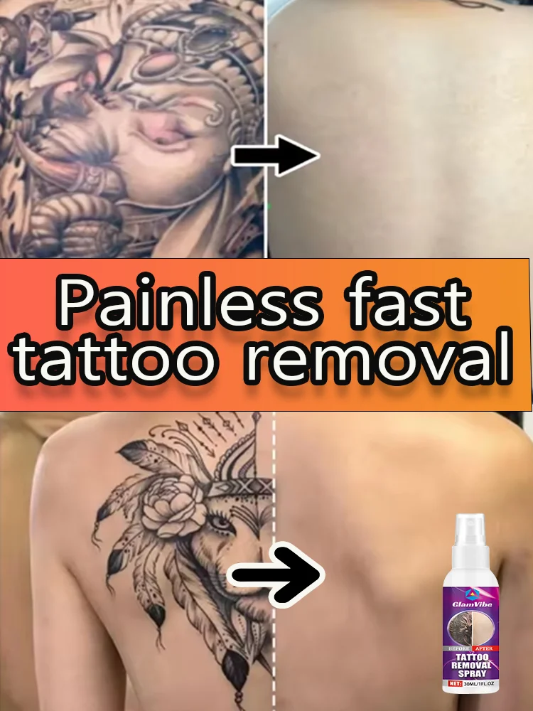 

Tattoo removal dissolves painlessly deep cleans tattoos