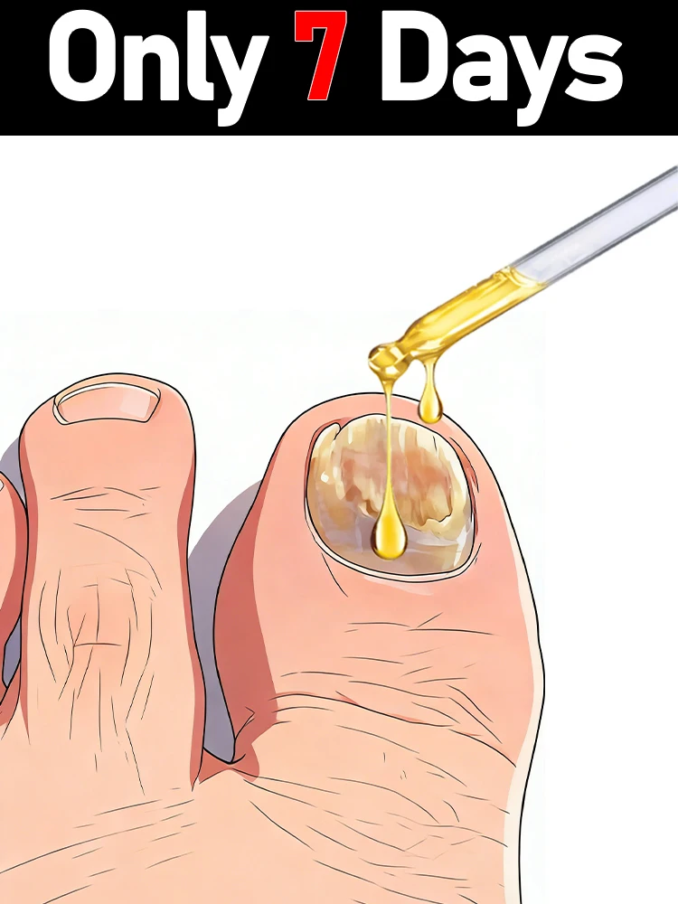 

Масло от грибка ногтей восстанавливает утолщенные, поврежденные и потускневшие ногти; подходит для ногтей на ногах и руках.