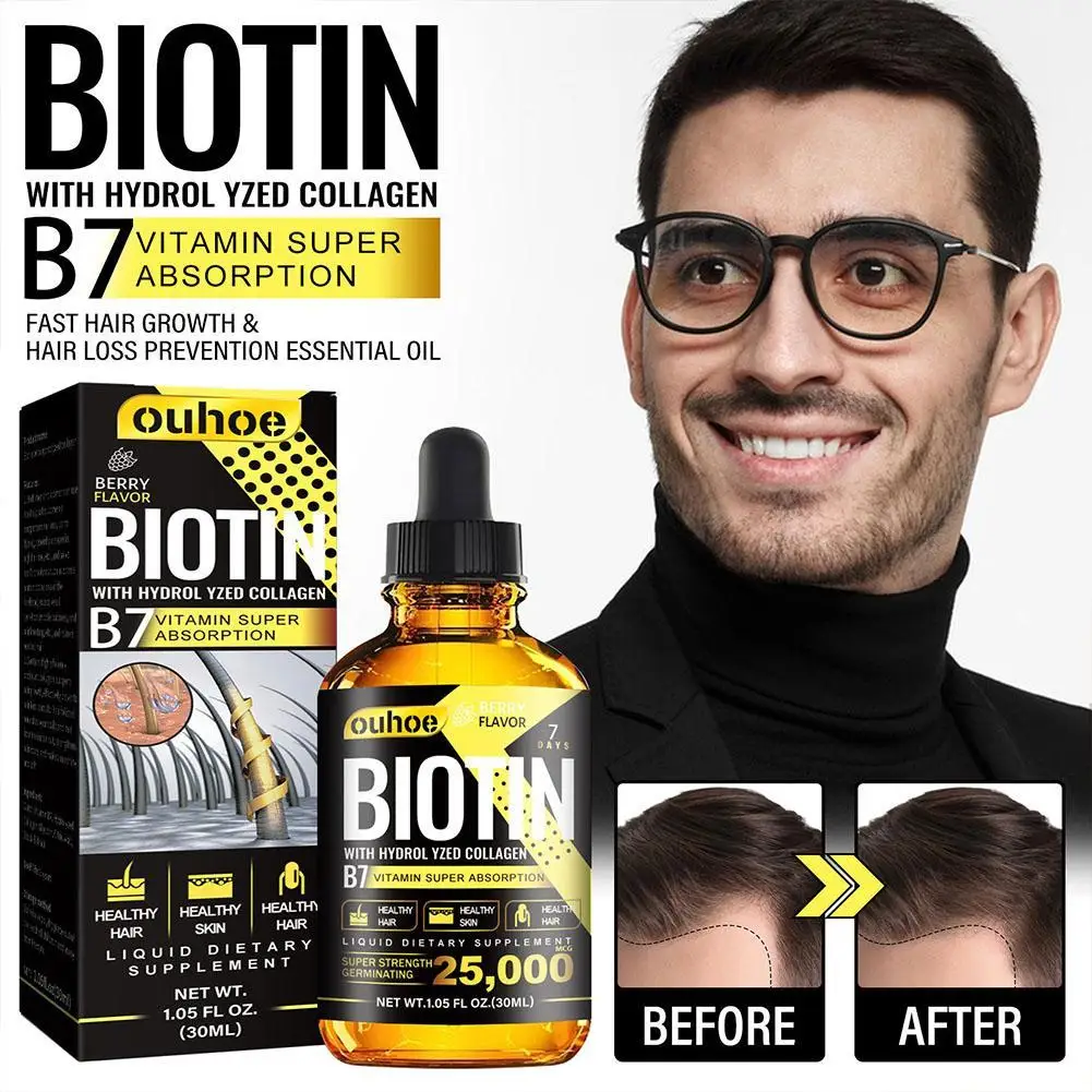 

30ml Products Biotin Fast Growing Hair Care Essential Oils Anti Hair Loss Spray Scalp Treatment For Men Women