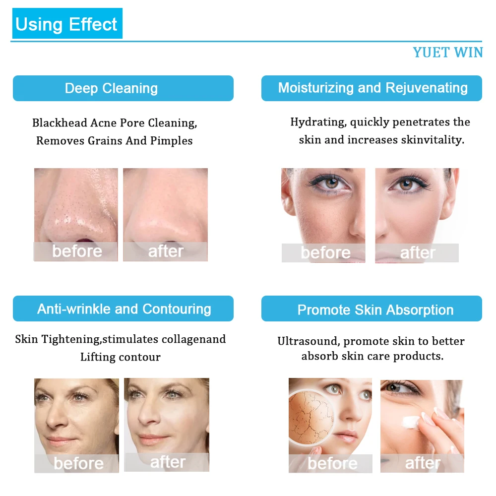 Neue 6 in 1 Hydro Derma brasion Maschine H2O2 Gesichts reinigung Hydro peeling Lifting Hautpflege Schönheits gerät profession ellen Salon