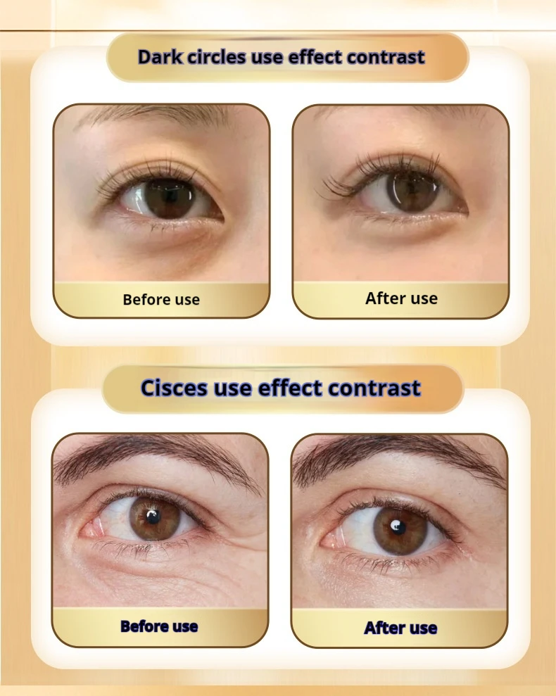 New Eye Lift Massage Hot Compress Black Eye Beauty Instrument