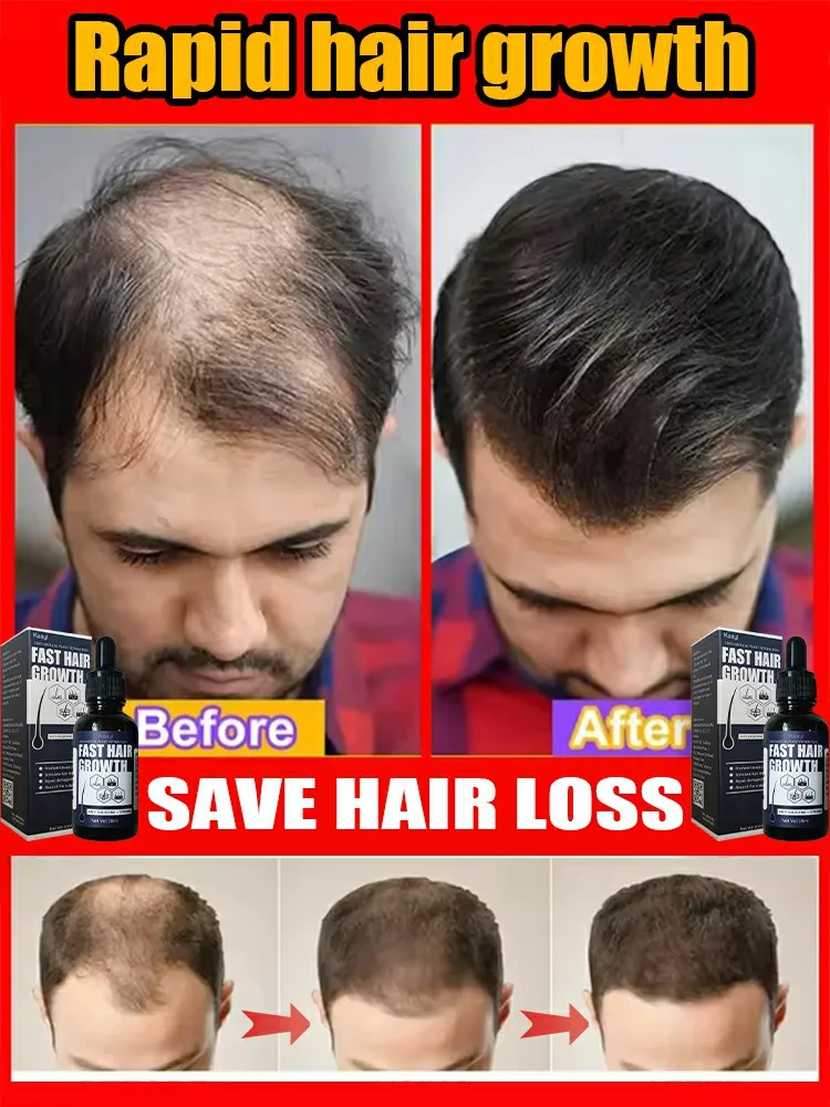 

98% of buyers buy again, have more and more hair, say goodbye to baldness, thick hair,Hot selling product.