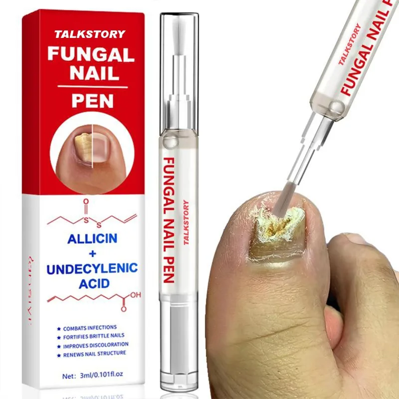 

Жидкая ручка для удаления грибка ногтей, онихомикоза, паронихии, против инфекции, ремонт грибка пальцев, уменьшение инфекции пальцев, жидкость для ухода за ногтями