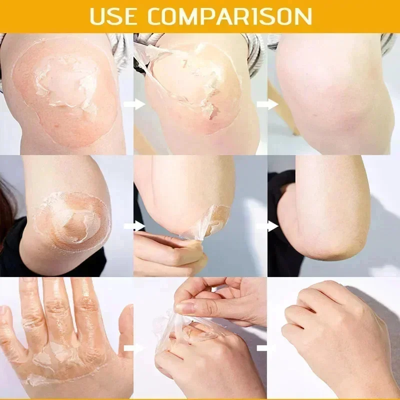 Gele Peeling Lotion Olie 100% Biologisch Bleken Donkere Huid Exfoliërende Whitening Voedende Hyaluronzuur Moisturizer Body Scrub